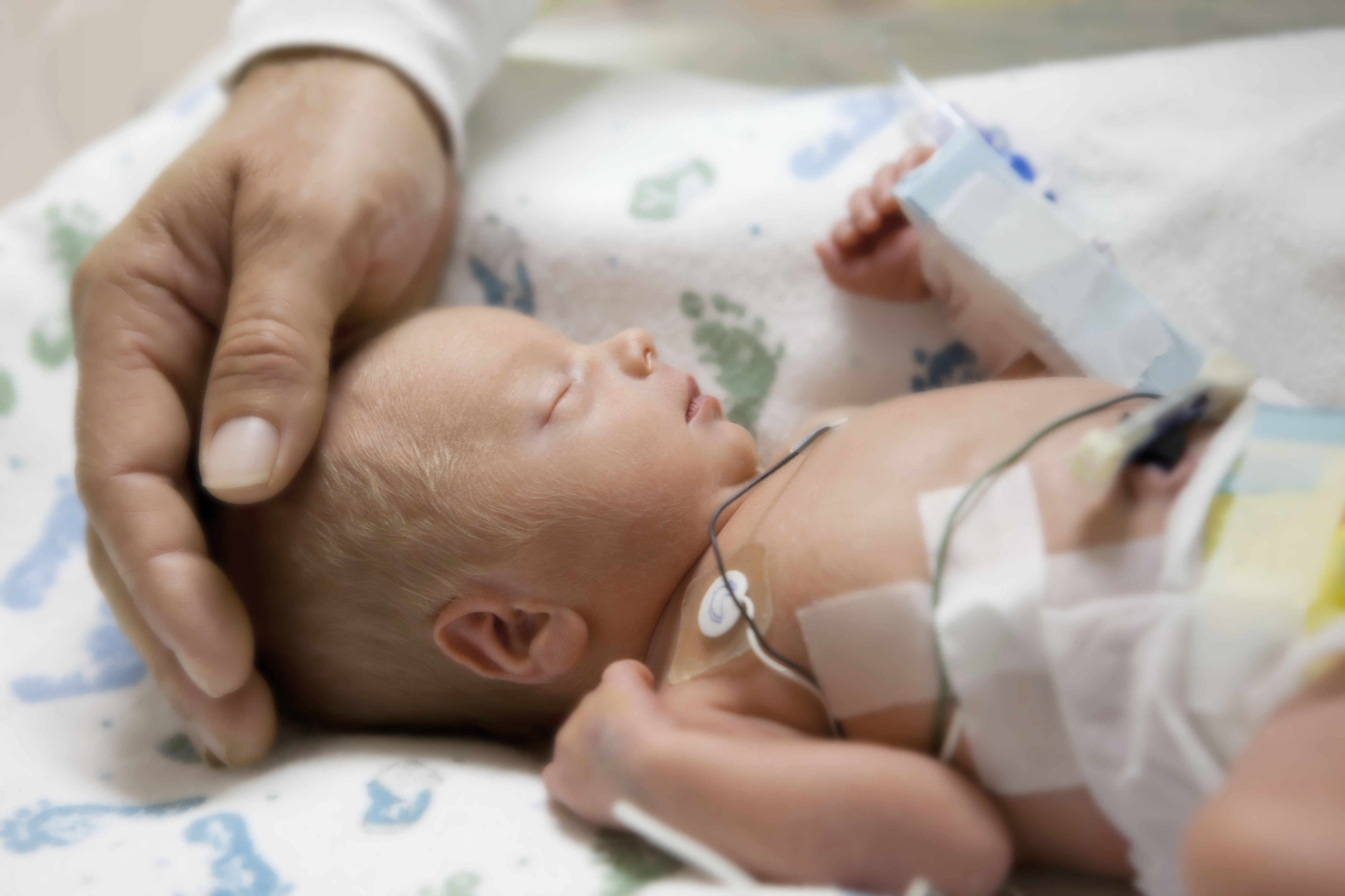 Новорожденный стресс. Неонатальный сепсис у новорожденных. Перинатальная энцефалопатия у новорожденных. Асфиксия новорожденных.